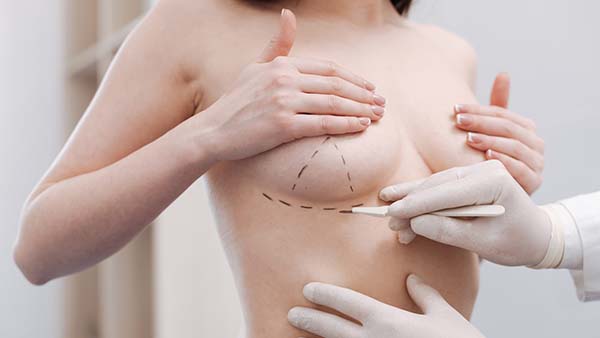Tracé d'un chirurgien pour un lifting mammaire