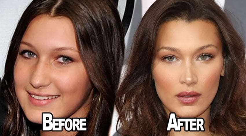 Résultat avant et après d'un Fox Eyes