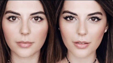 Photo avant et après d'un Fox Eyes