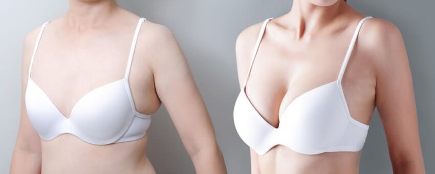 Photo avant et après